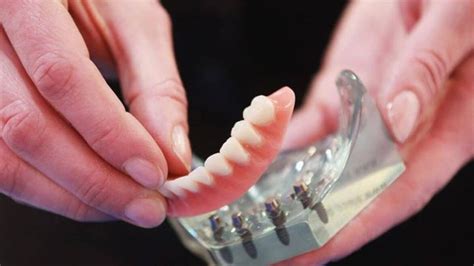 Top 10 Best affordable dentures and implants Near Mesa, Arizona